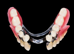 what is fixed prosthodontics